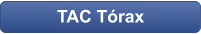 TAC Tórax